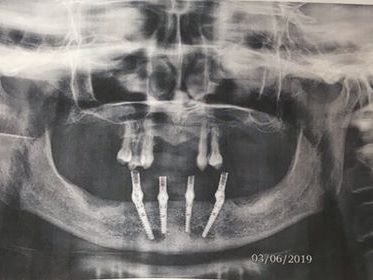 Dr. Carter - Dental Care Dr. Carter - Dental Care